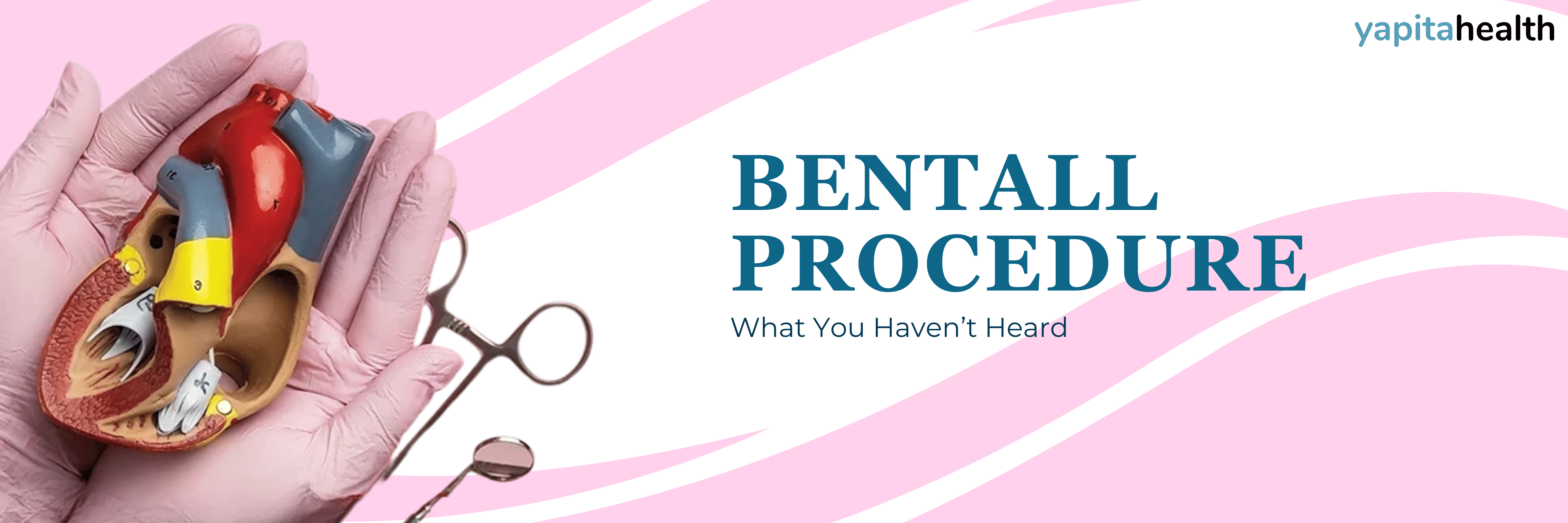 Bentall Procedure - Yapita Health
