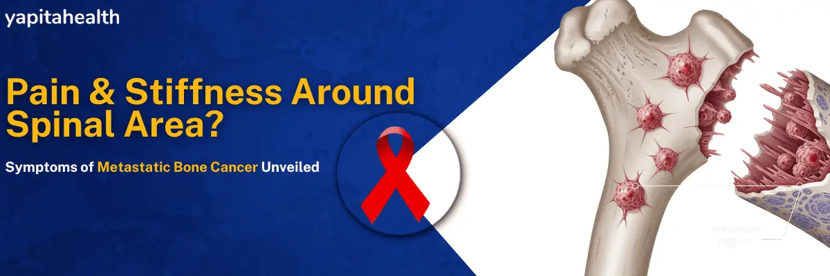 Symptoms of Metastatic Bone Cancer - Yapita Health