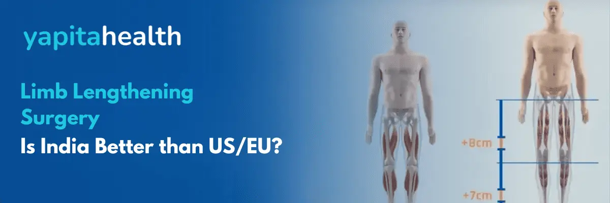 Limb Lengthening Surgery in India - Yapita Health