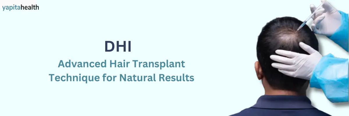 DHI: The Advanced Hair Transplant Technique for Natural Results