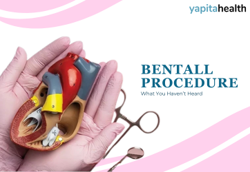 Bentall Procedure - Yapita Health