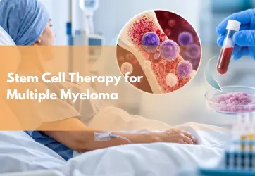 Stem cell therapy for multiple myeloma