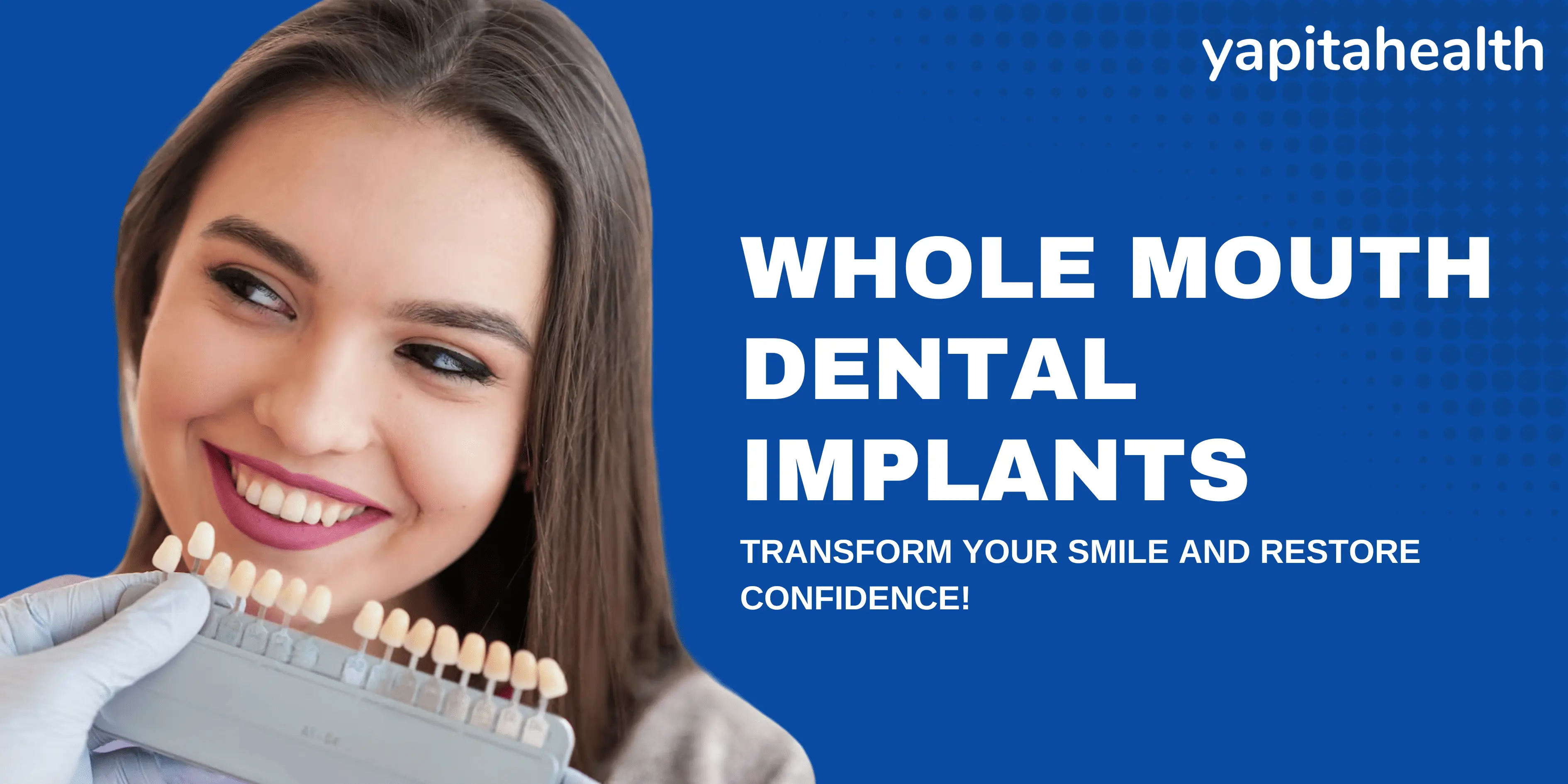 Can You Get Dental Implants for Your Whole Mouth?