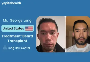 George Leng's Beard Transplant Journey - Yapita Health