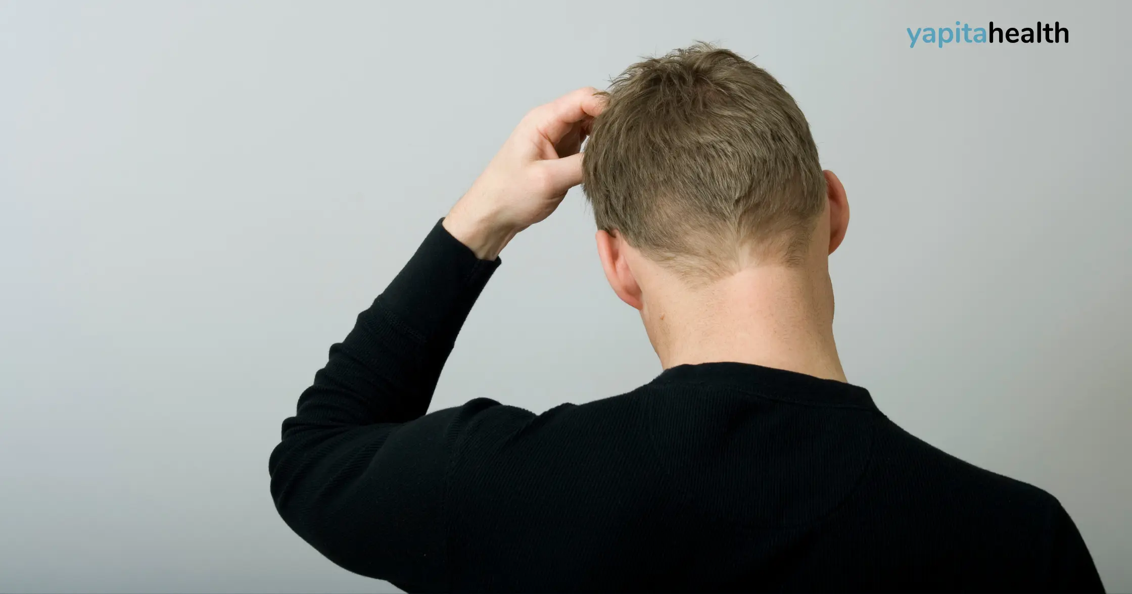 itching after hair transplant is common