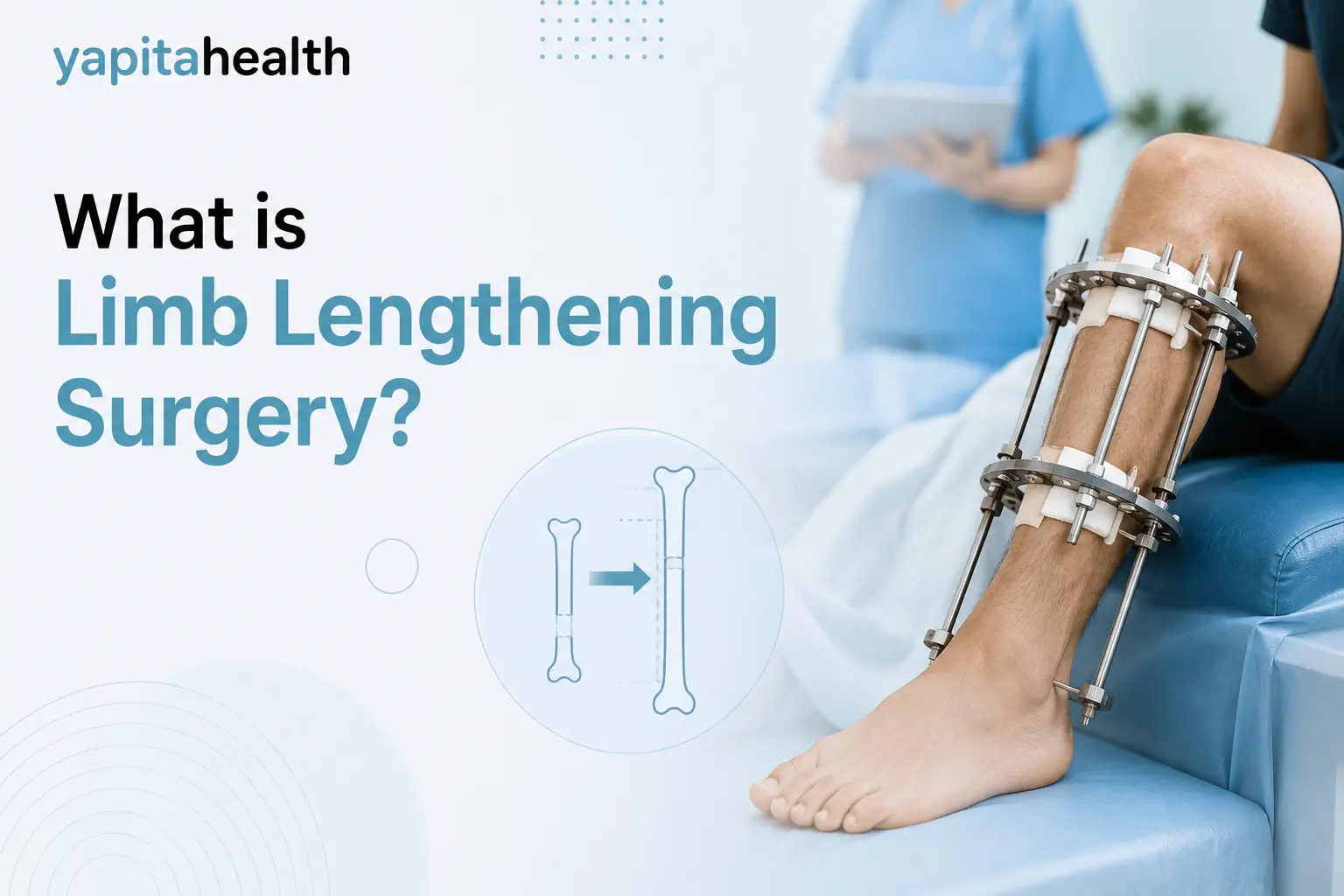 What is Limb Lengthening Surgery