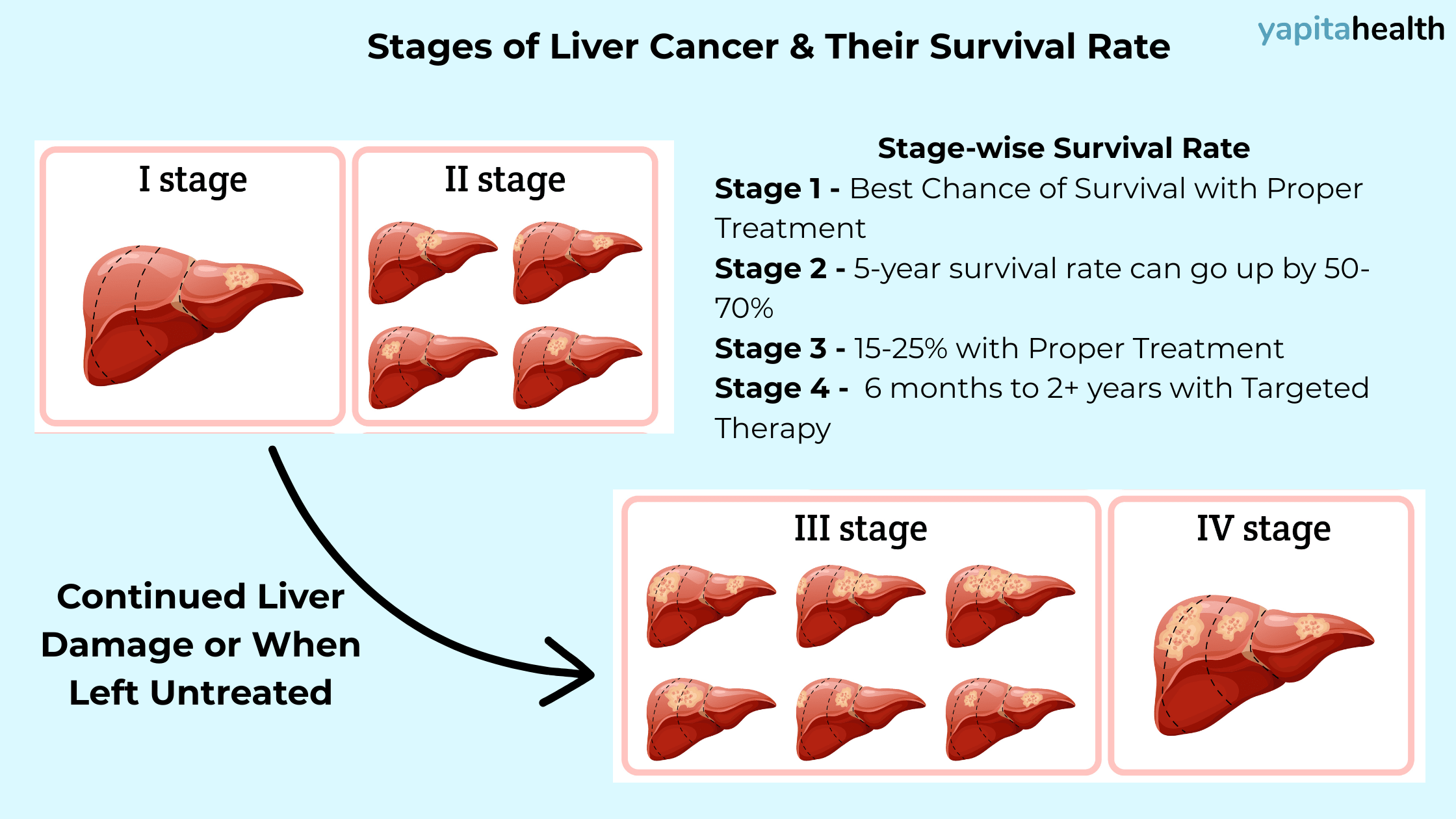 stages of liver cancer and survival rates