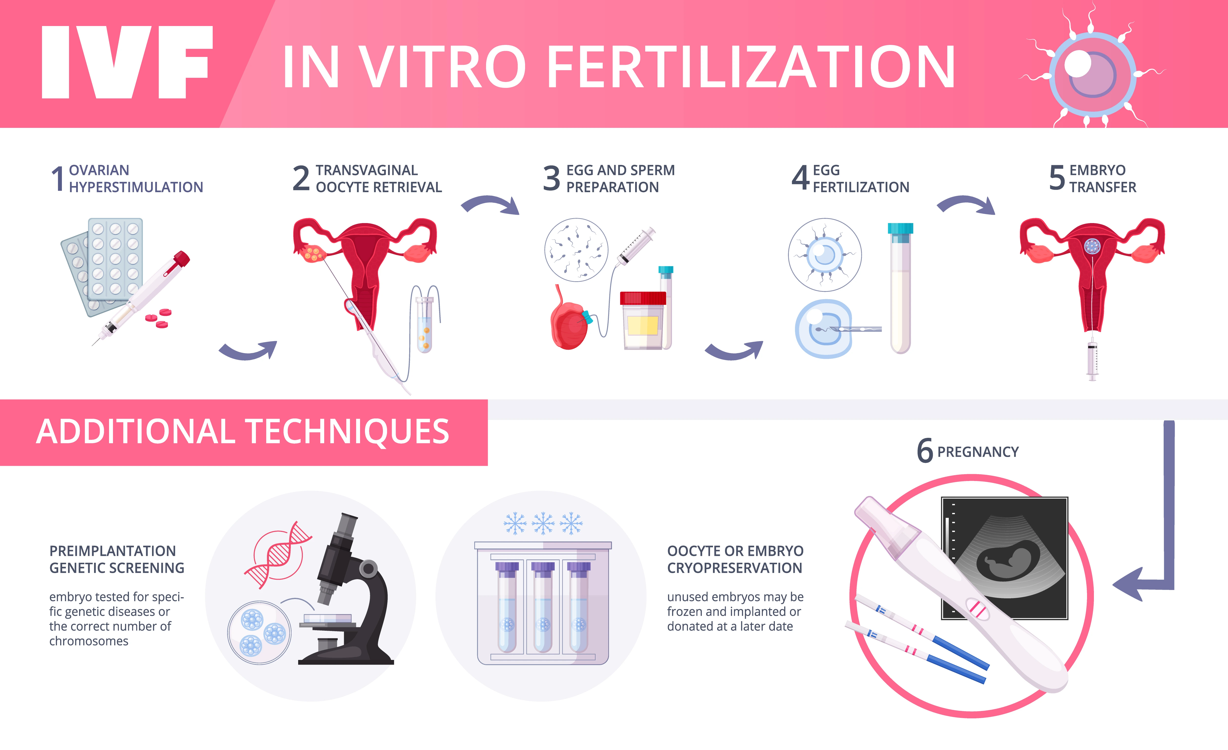 IVF procedure and other types